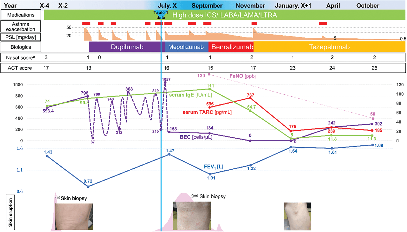Figure 2. Clinical course of the patient. ICS, inhaled corticosteroids; LABA, long-acting β2 agonists; LAMA, long-acting muscarinic antagonists; LTRA, leukotriene receptor antagonists; OCS, oral corticosteroids; ACT, asthma control test; BEC, blood eosinophil count; TARC, thymus and activation-regulated chemokine; FeNO, fractional exhaled nitric oxide. aThe nasal congestion or obstruction score was assessed according to the evaluation method used in the LIBERTY NP SINUS-52 study.