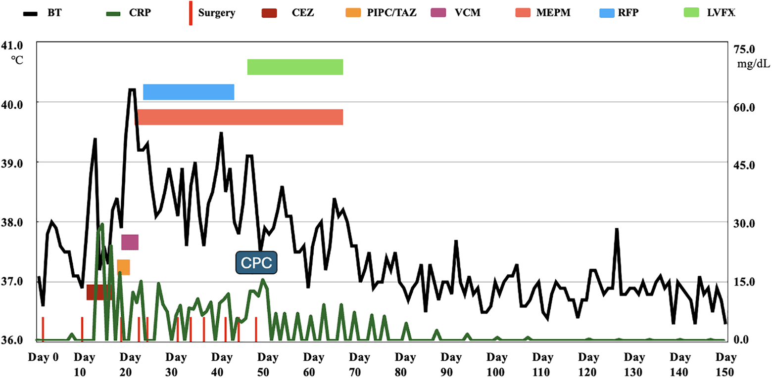 Figure 2. Clinical Course of the Patient. BT: body temperature, CRP: C-reactive protein, CEZ: cefazolin, PIPC/TAZ: piperacillin/tazobactam, VCM: vancomycin, MEPM: meropenem, RFP: rifampicin, LVFX: levofloxacin, CPC: calcium phosphate bone cement.