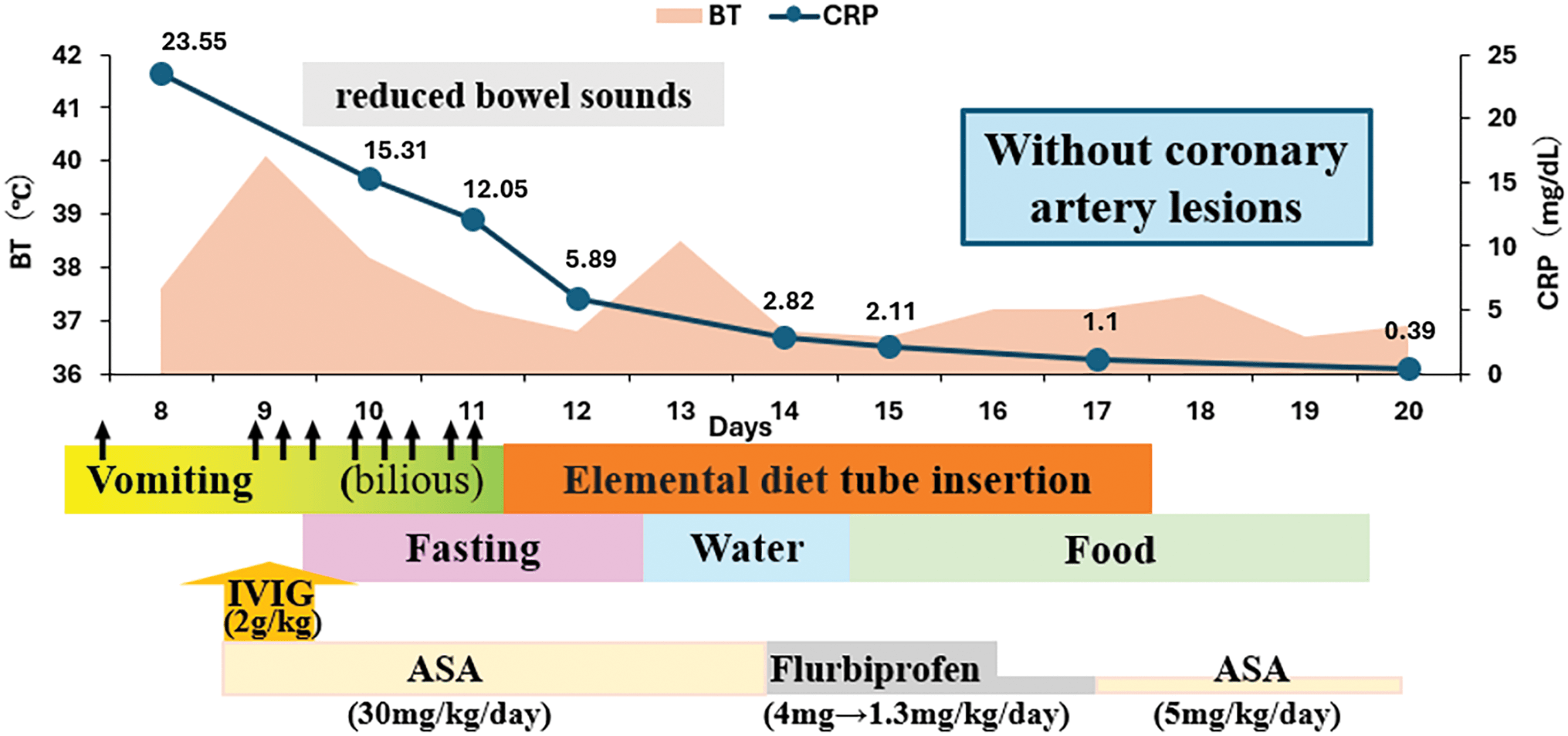 Figure 1. Clinical course of the patient. BT: body temperature; CRP: C-reactive protein; IVIG: intravenous immunoglobulin; ASA: aspirin.