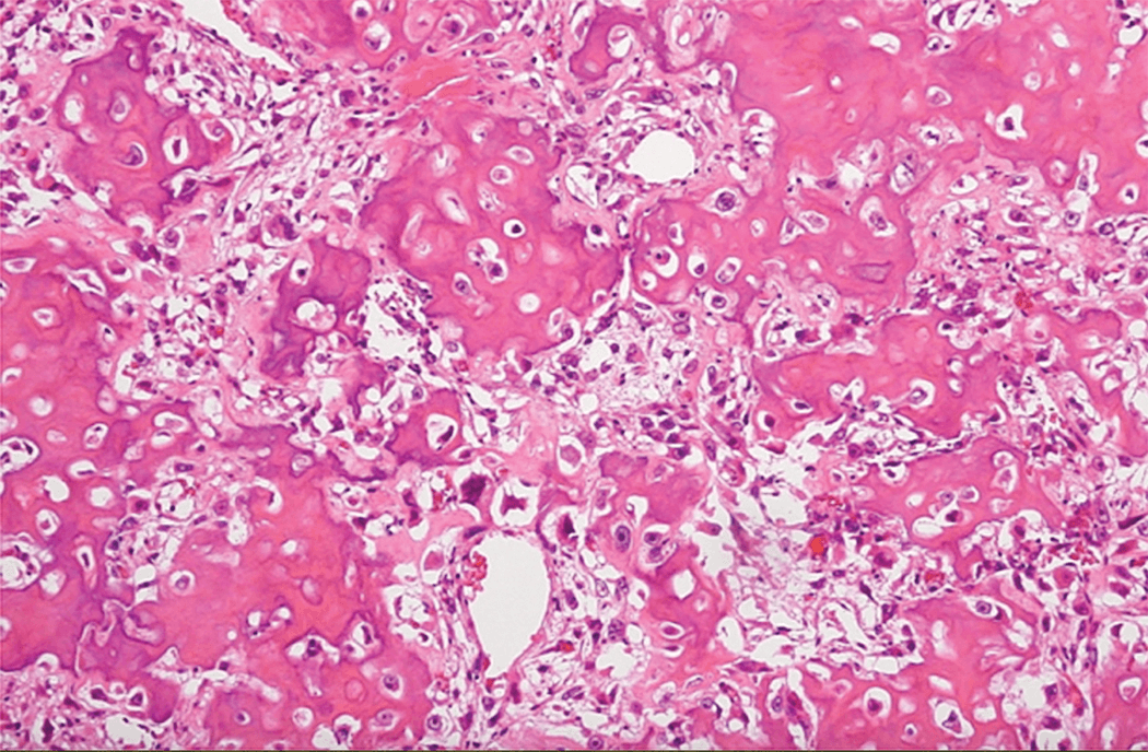 Figure 2. Pathological diagnosis based on H&E-stained sections. H&E, hemtoxylin and eosin.